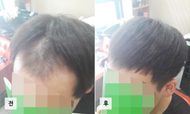 갤러리