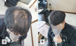 갤러리